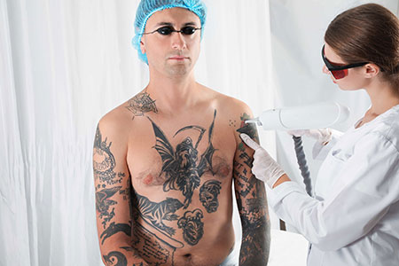 Man undergoing tattoo removal procedure Tucson, AZ at Beauty & Health by Liz