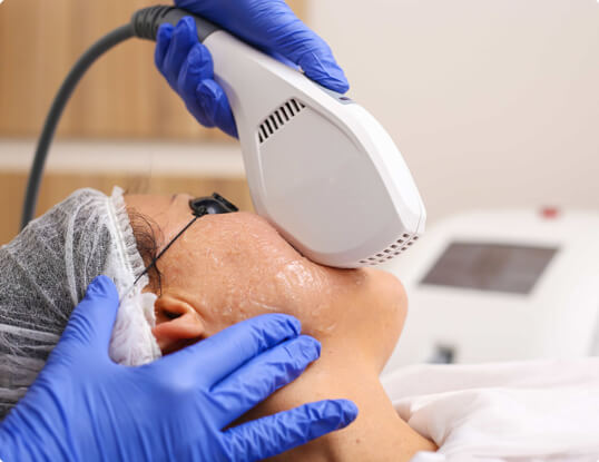 IPL Photofacial at Beauty & Health by Liz